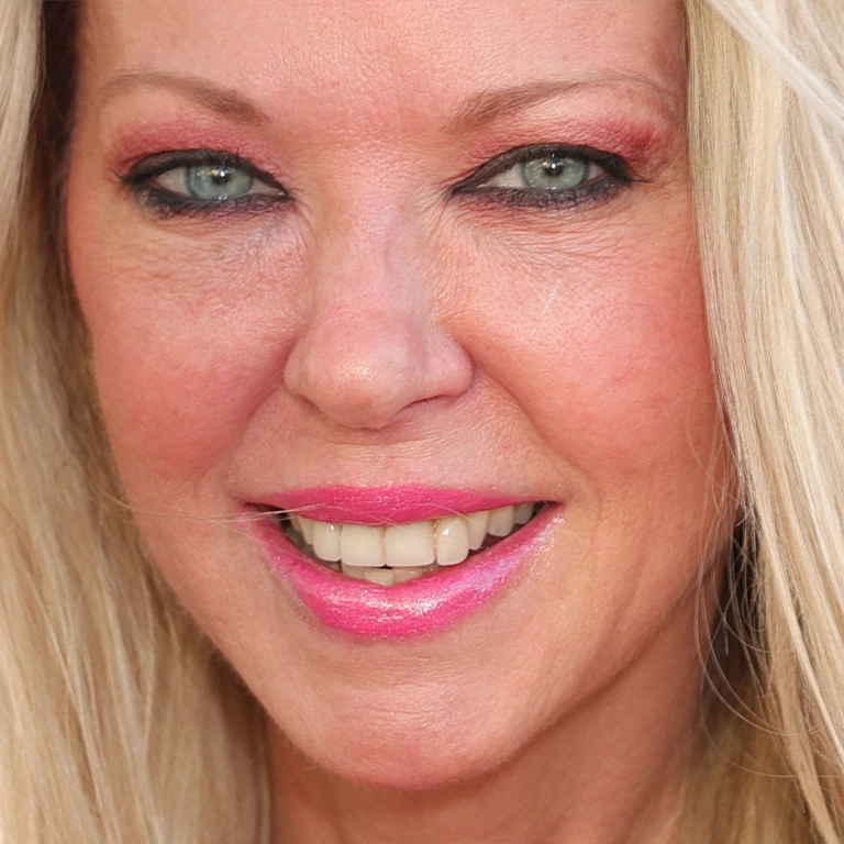 Dental Implants in Turkey