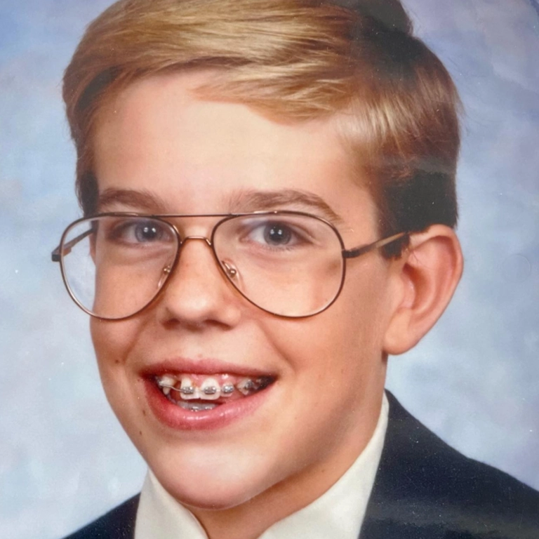 Ed Helms Cosmetic Dentistry