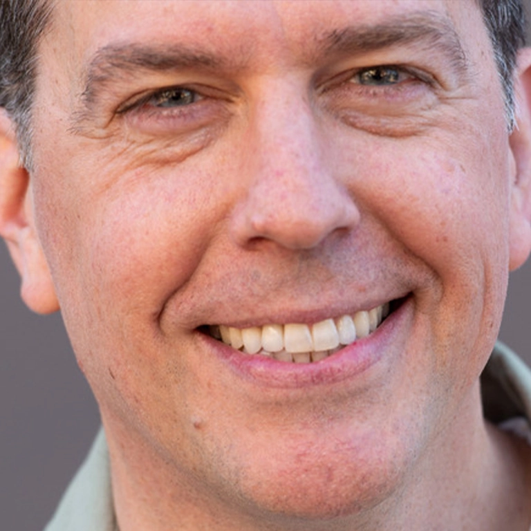 Ed Helms Teeth Transformation