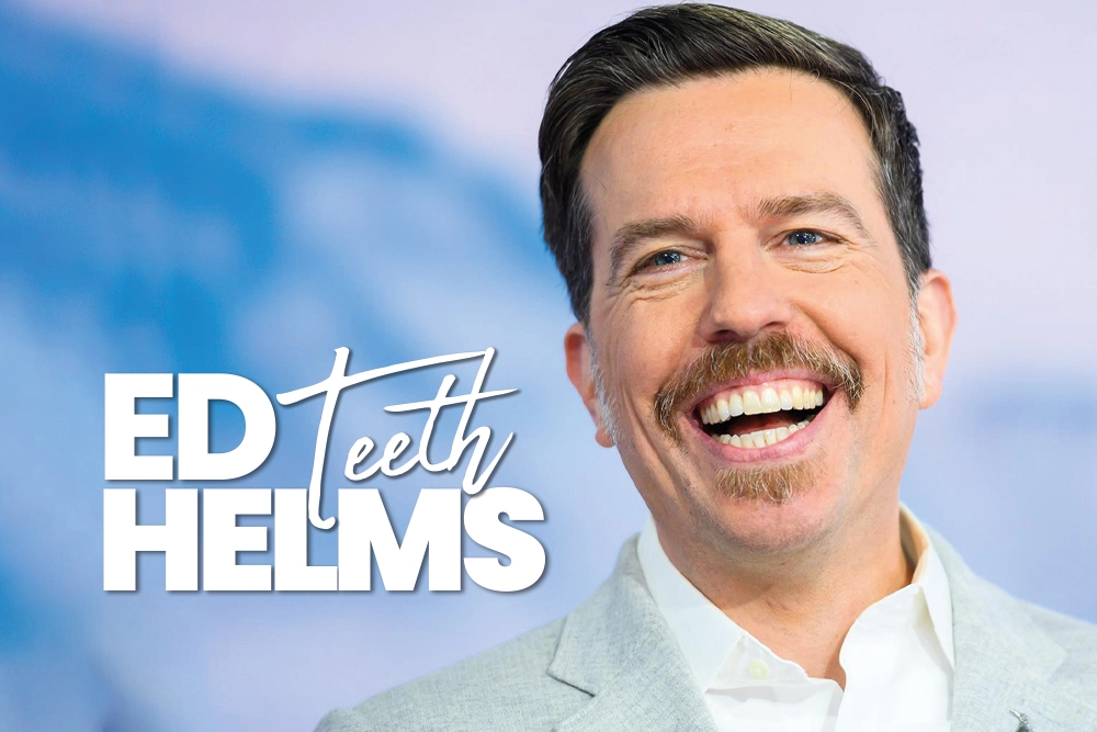 Ed Helms Teeth