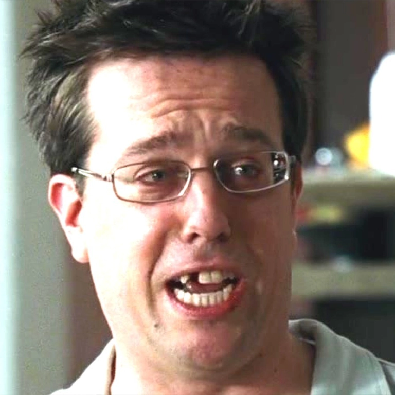 Ed Helms Veneers