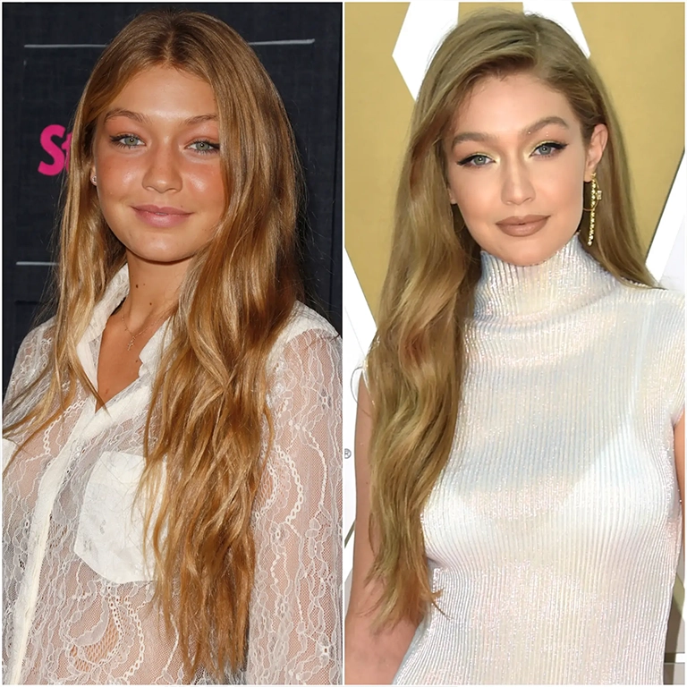 Gigi Hadid Eyelid Surgery Claims