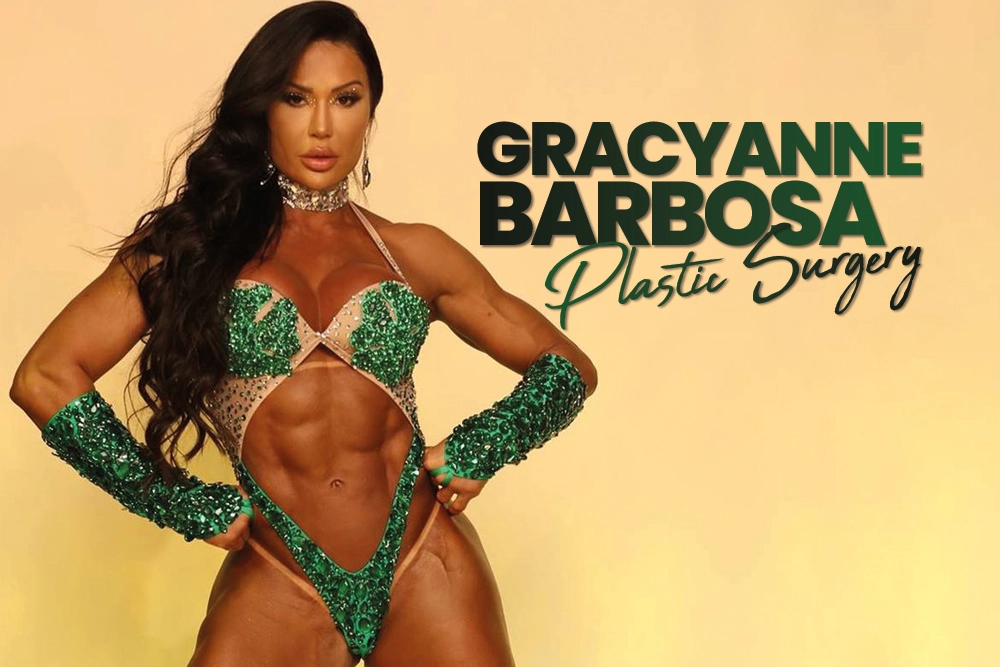 Gracyanne Barbosa Plastic Surgery