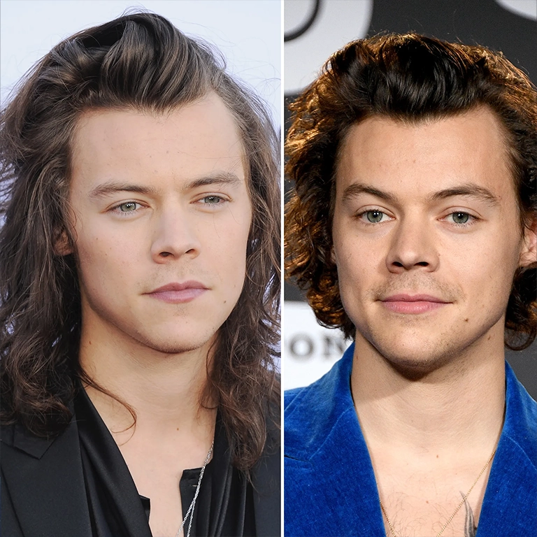 Harry Styles Hair Density Change