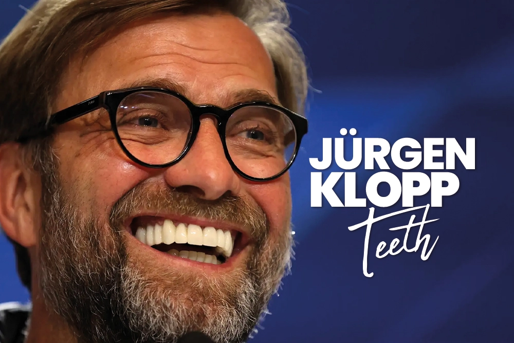 Jürgen Klopp Teeth