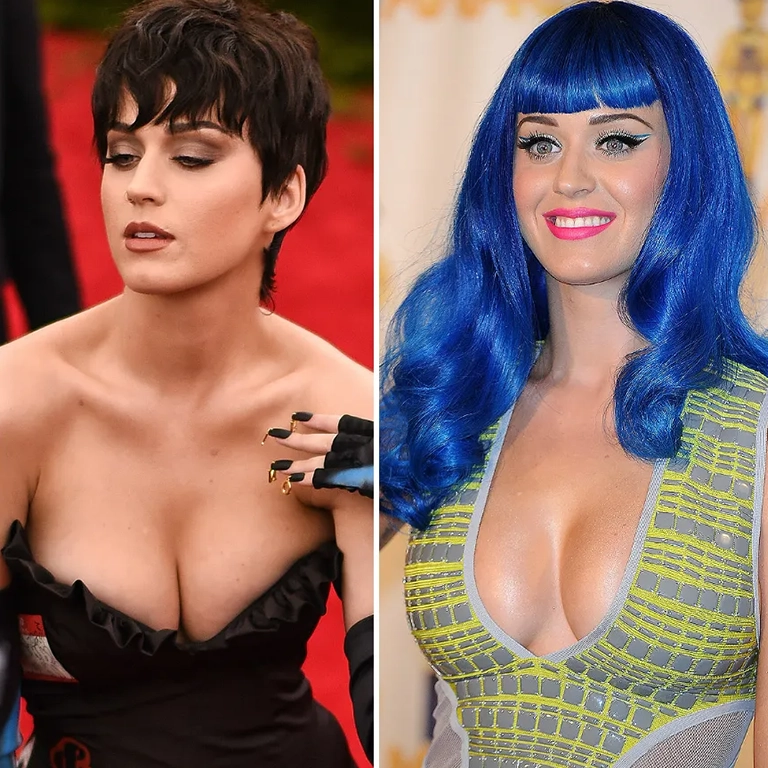 Katy Perry Cosmetic Procedures