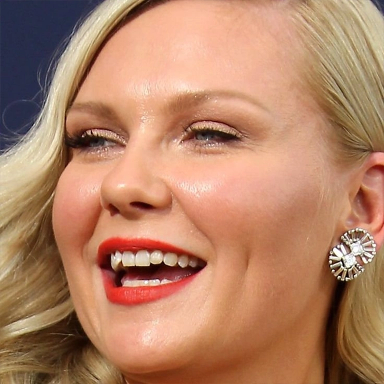 Kirsten Dunst Teeth Whitening