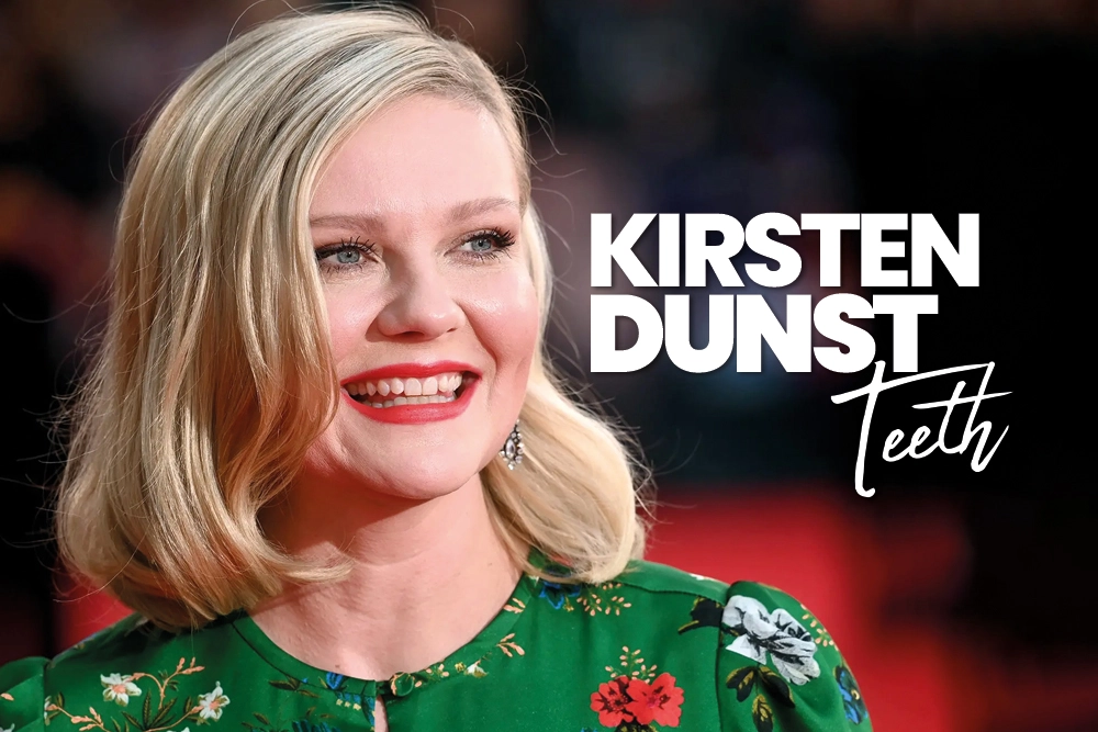 Kirsten Dunst Teeth