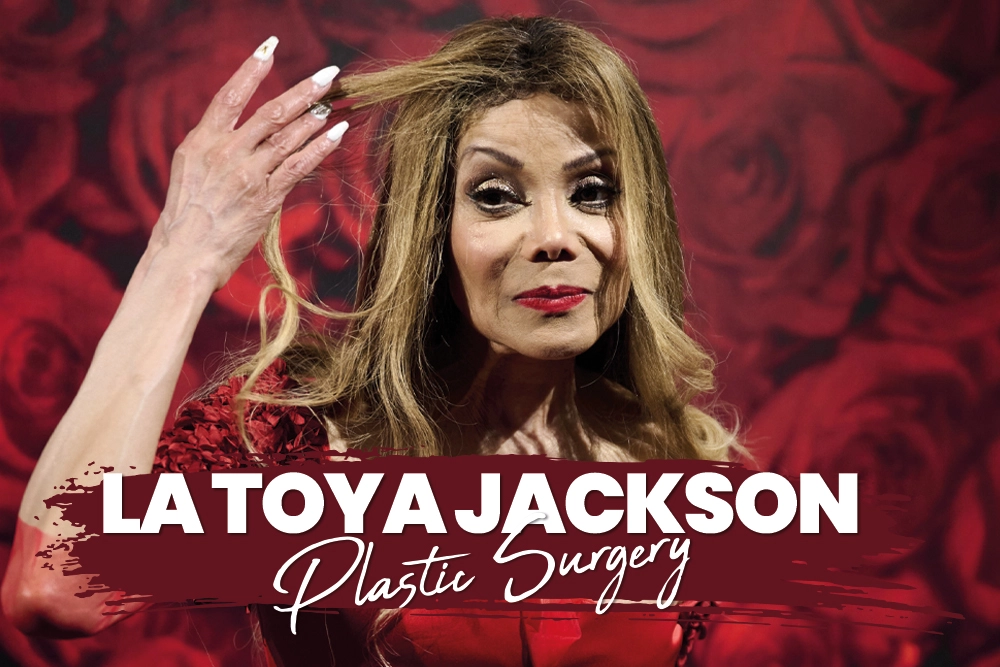 La Toya Jackson Plastic Surgery