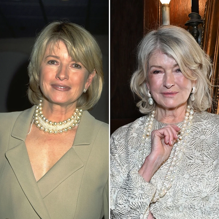 Martha Stewart Plastic Surgery Before and After