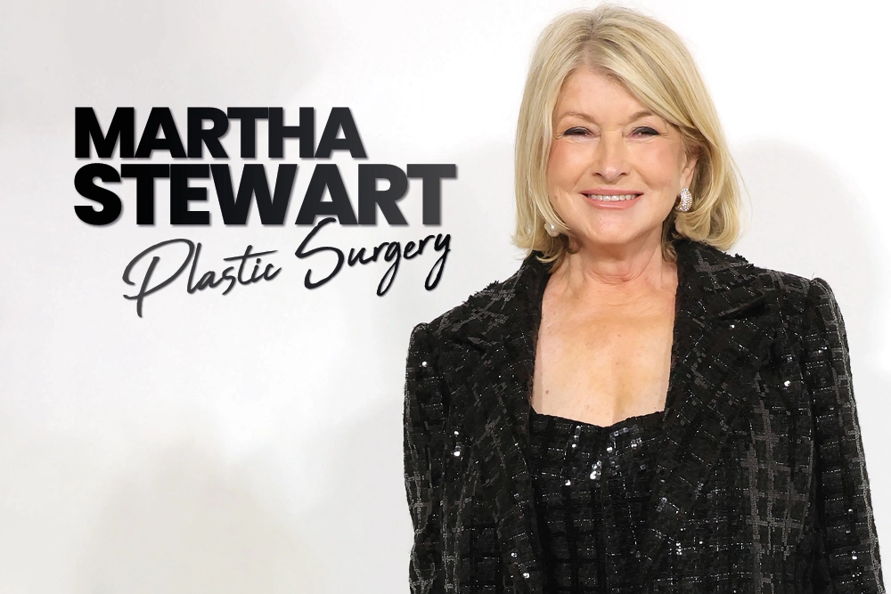 Martha Stewart Plastic Surgery