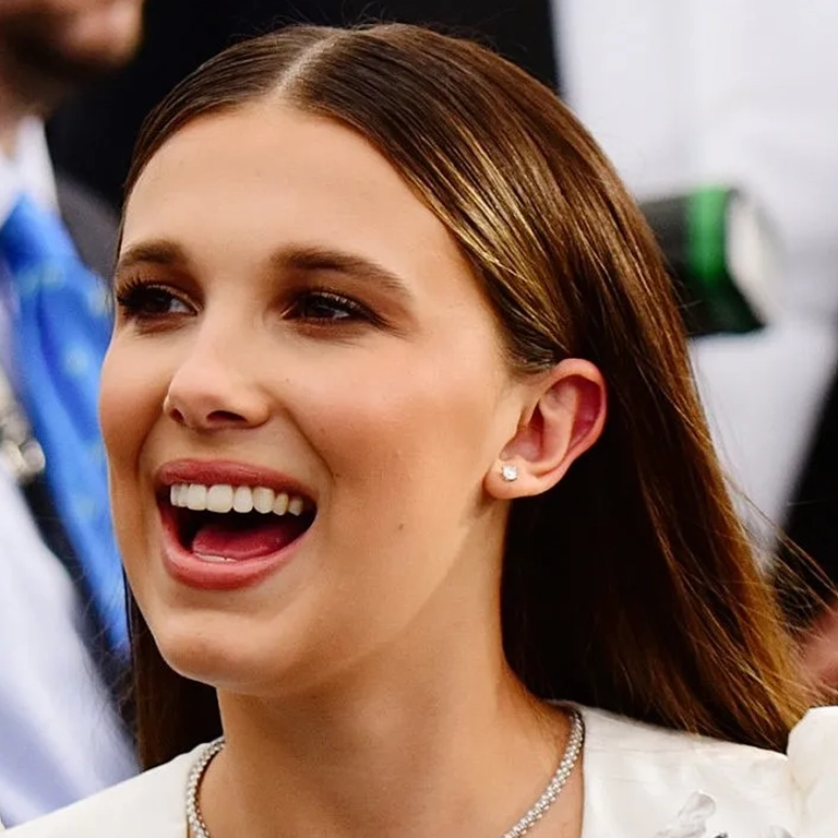Millie Bobby Brown Teeth Before and After