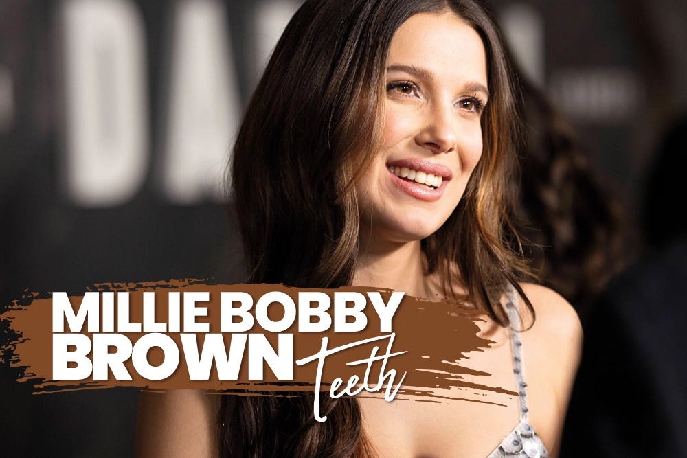 Millie Bobby Brown Teeth