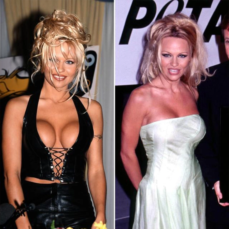 Pamela Anderson Aesthetics Over Time