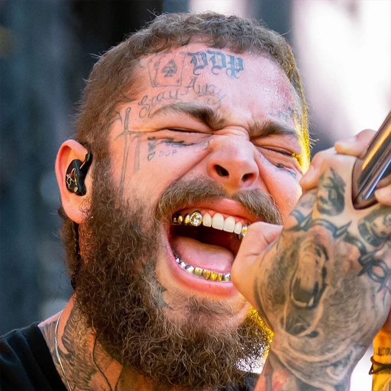 Post Malone Teeth Before After