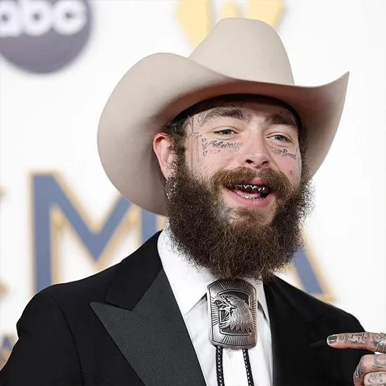 Post Malone Teeth Rumors