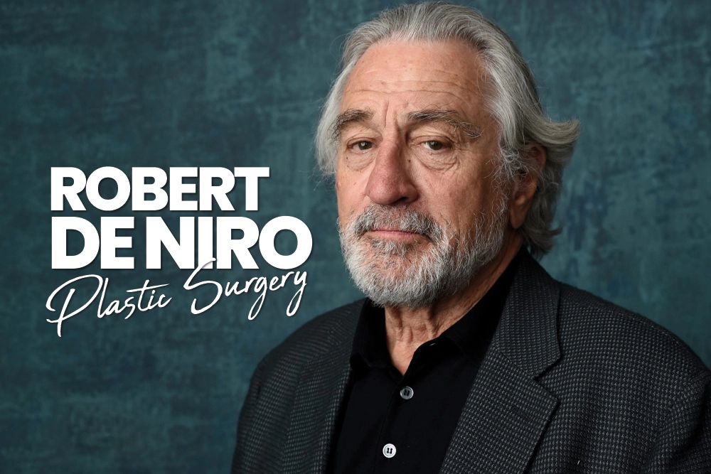 Robert De Niro Plastic Surgery