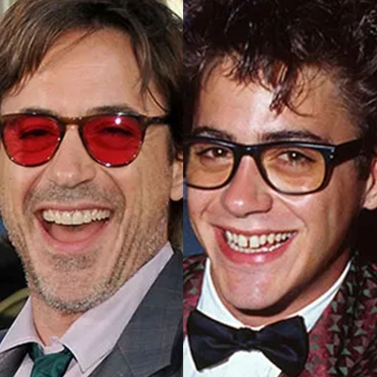 Robert Downey Jr. Cosmetic Dentistry