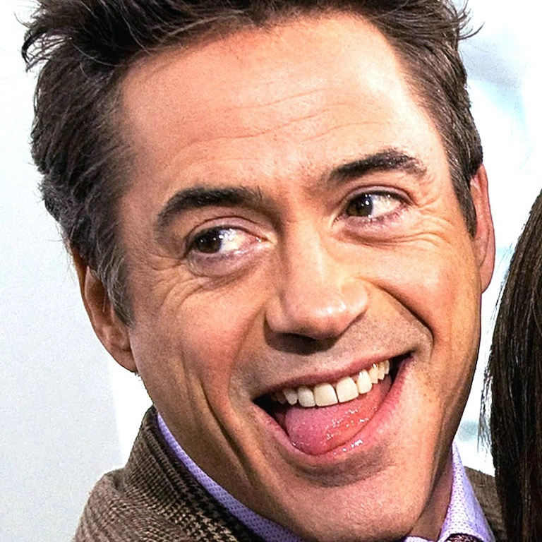 Robert Downey Jr. Teeth Transformation