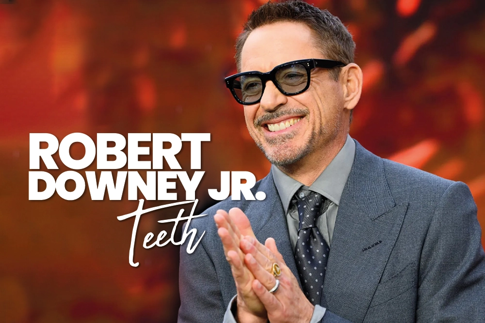 Robert Downey Jr. Teeth