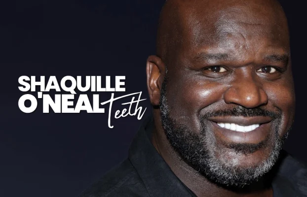 Shaquille O’Neal Teeth