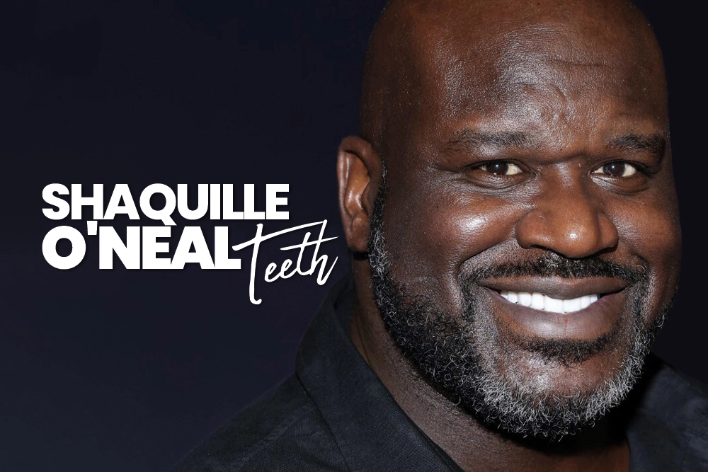 Shaquille O’Neal Teeth