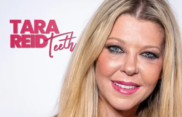 Tara Reid’s Smile Transformation