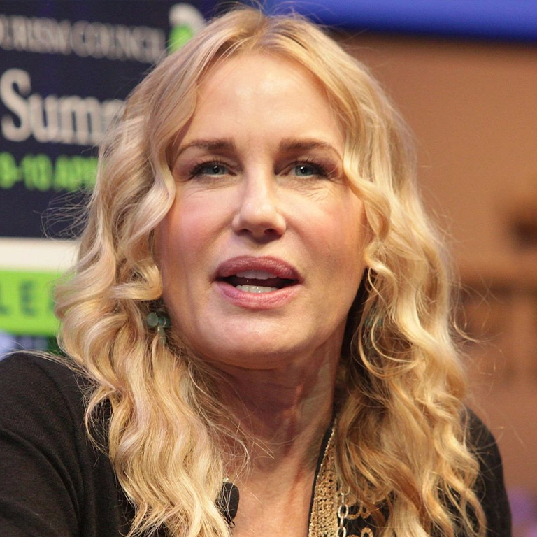 The Difference Between Fillers and a Facelift