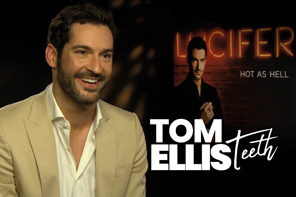 Tom Ellis Teeth