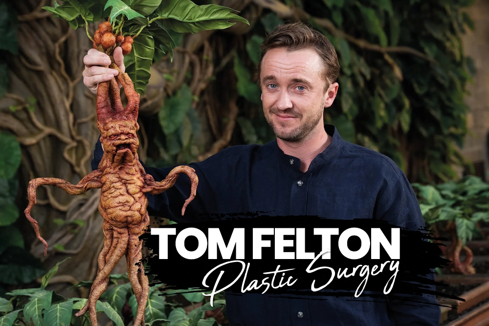 Tom Felton Plastic Surgery