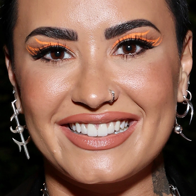 What Happened to Demi Lovato Teeth