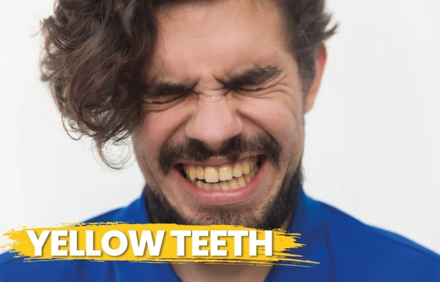 Yellow Teeth