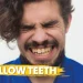 Yellow Teeth