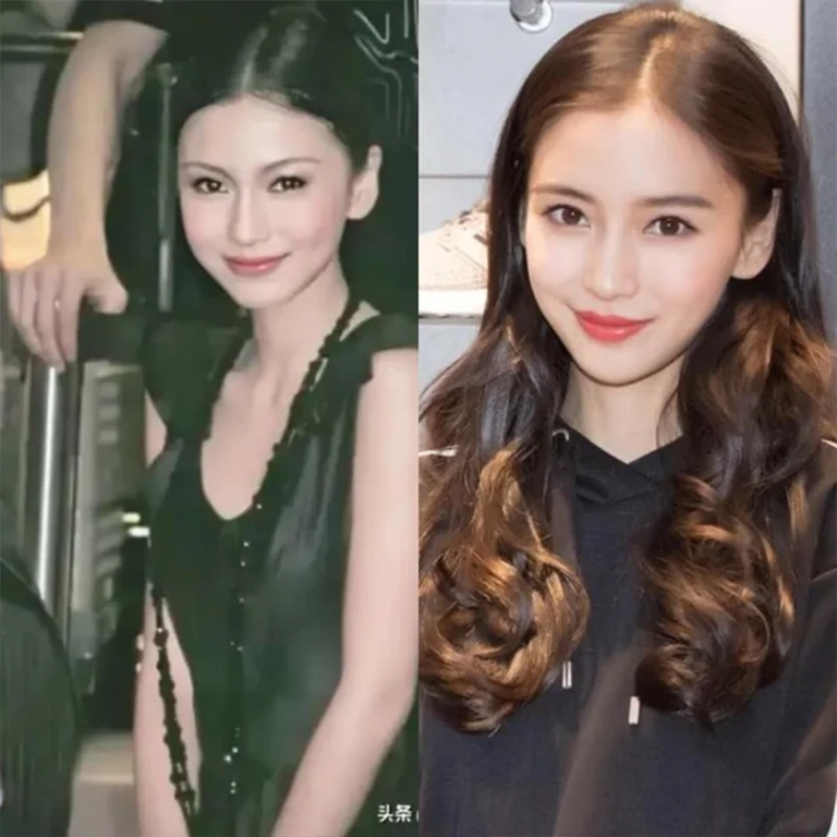 Angelababy Plastic Surgery Before After