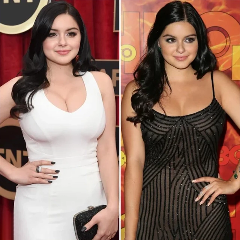 Ariel Winter's Life-Changing Breast Reduction Story