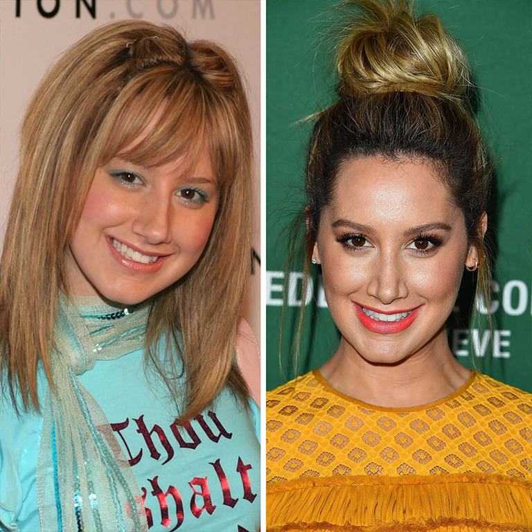 Ashley Tisdale Rhinoplasty Before and After