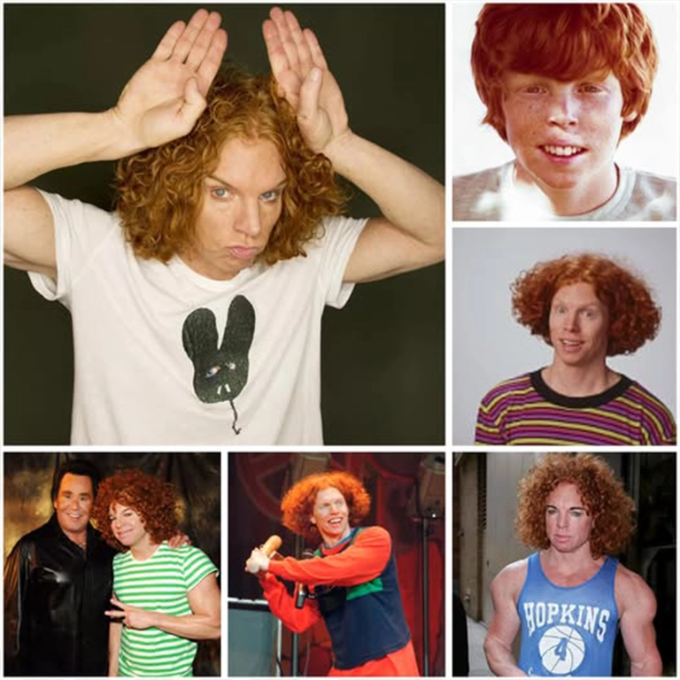Carrot Top Plastic Surgery Before and After