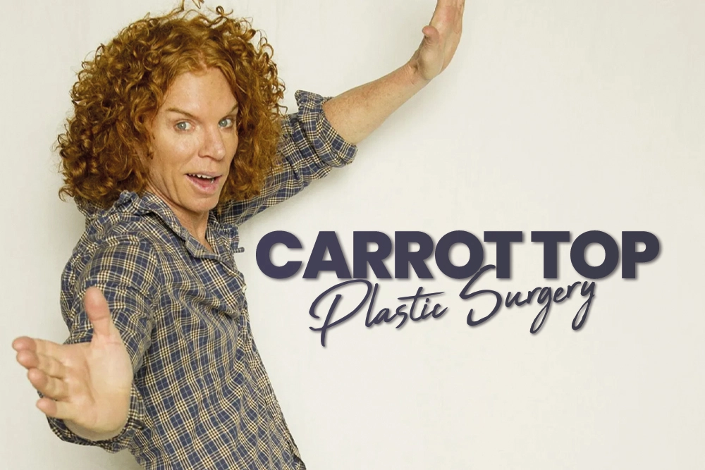 Carrot Top Plastic Surgery
