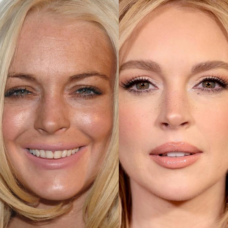 Choosing a Reputable Clinic for Your Rhinoplasty