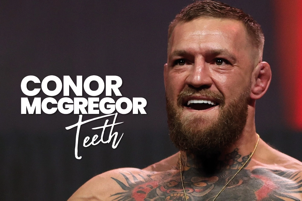 Conor McGregor Teeth