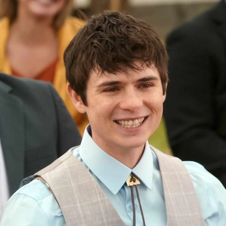 From Shark Teeth to a Perfect Smile A Look at Ashby Gentry Before