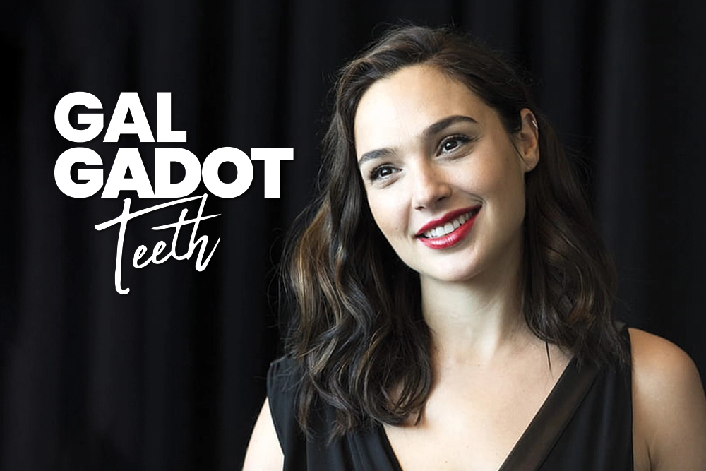 Gal Gadot Teeth