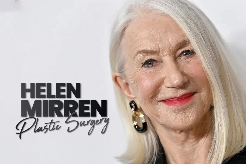 Helen Mirren Plastic Surgery