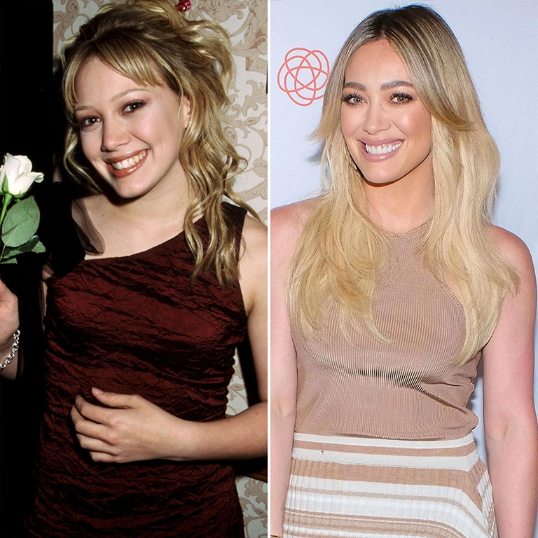 Hilary Duff Rhinoplasty Before and After