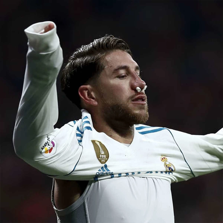 Is Sergio Ramos' Nose Natural
