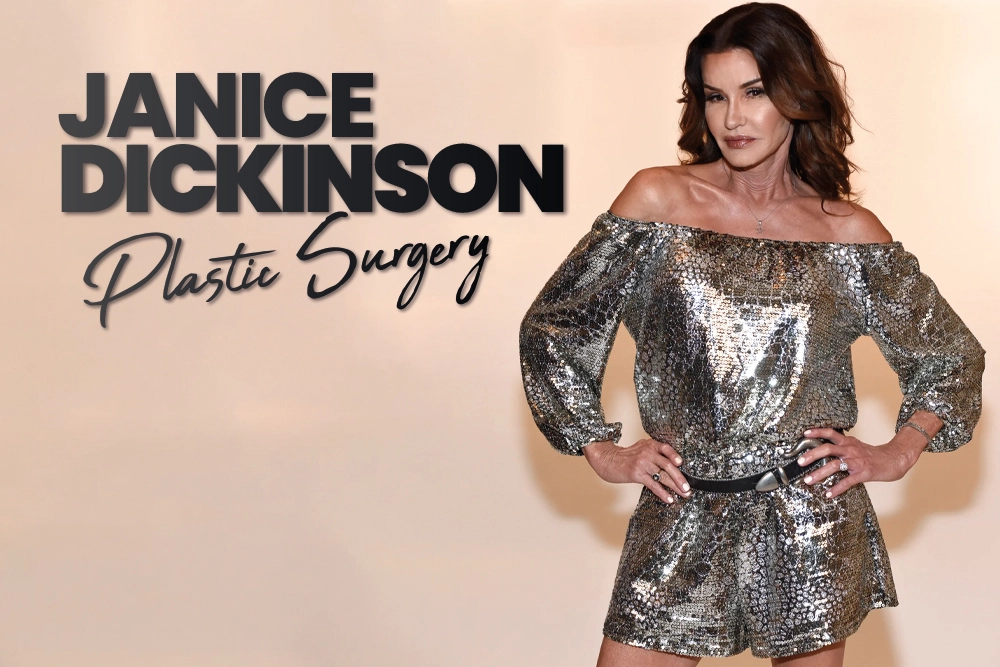 Janice Dickinson Plastic Surgery
