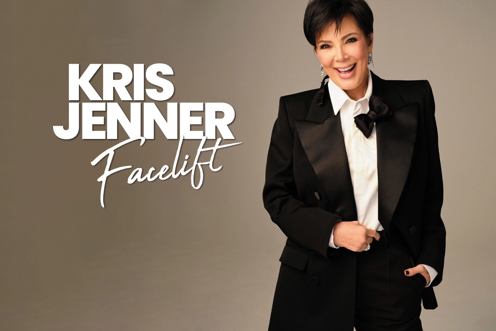Kris Jenner Facelift