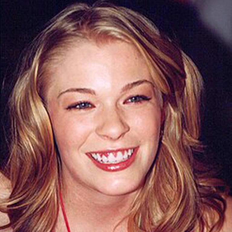 LeAnn Rimes Teeth Before and After