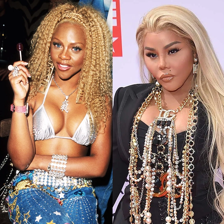 Lil Kim Plastic Surgery Reason