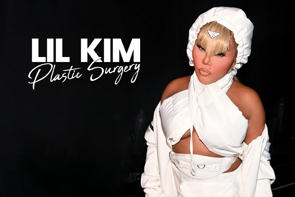 Lil Kim Plastic Surgery